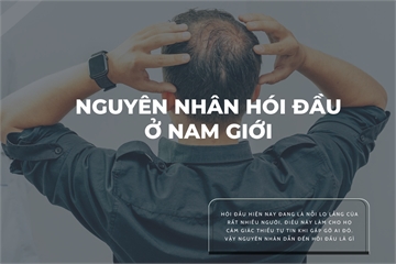 NGUYÊN NHÂN HÓI ĐẦU Ở NAM GIỚI