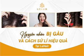 Nguyên Nhân Và Cách Xử Lý Gàu Một Cách Triệt Để